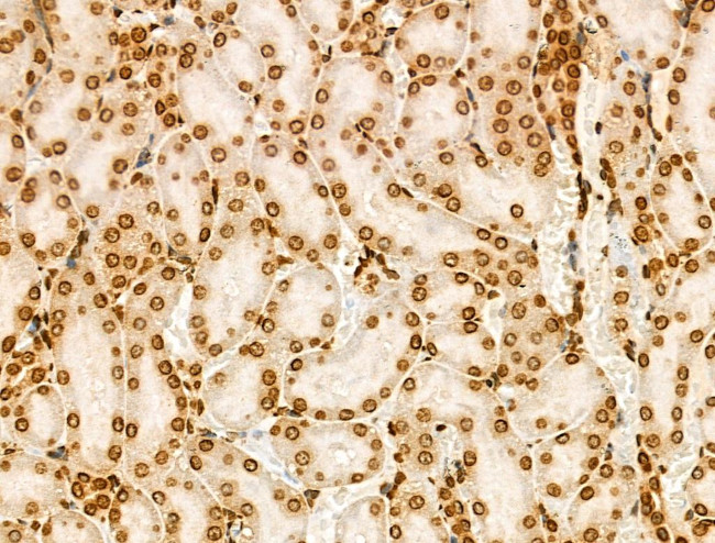 H2BK20ac Antibody in Immunohistochemistry (Paraffin) (IHC (P))