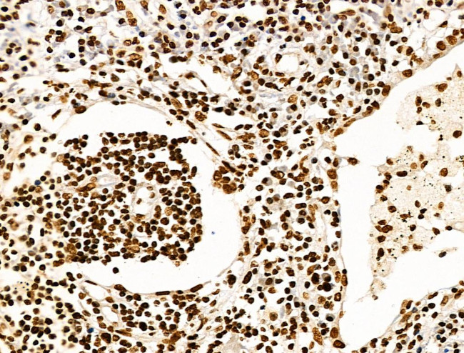 H2BK20ac Antibody in Immunohistochemistry (Paraffin) (IHC (P))