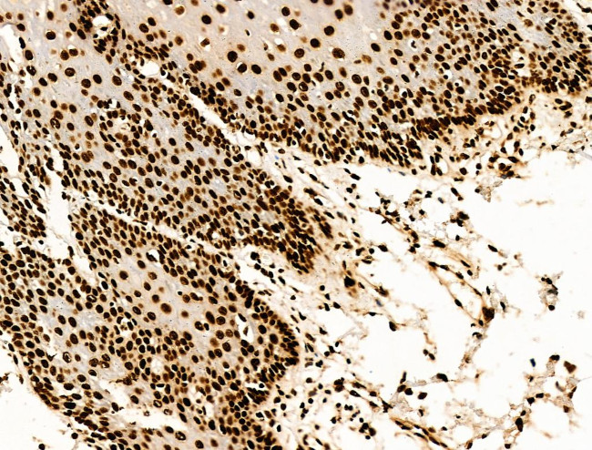 H2BK20ac Antibody in Immunohistochemistry (Paraffin) (IHC (P))