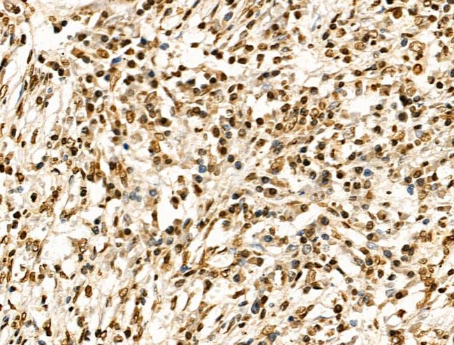 H2BK20ac Antibody in Immunohistochemistry (Paraffin) (IHC (P))