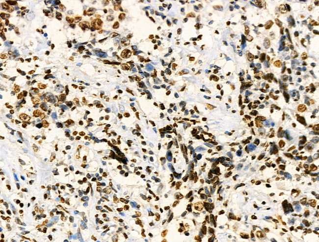 H2BK20ac Antibody in Immunohistochemistry (Paraffin) (IHC (P))