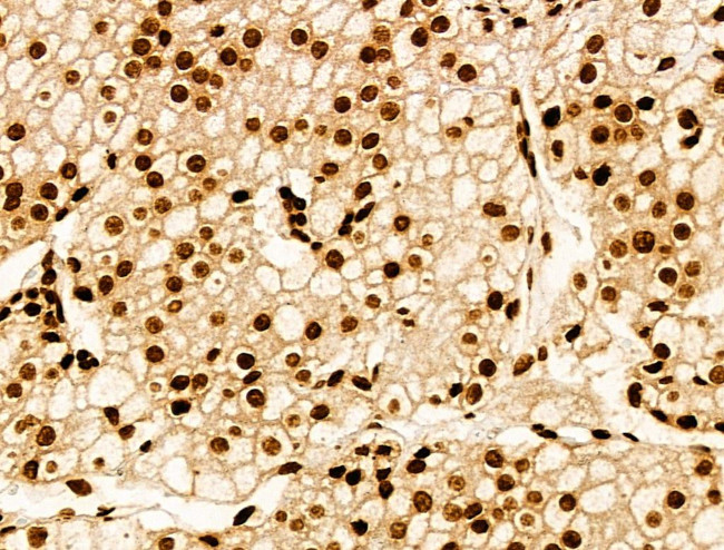 H2BK20ac Antibody in Immunohistochemistry (Paraffin) (IHC (P))