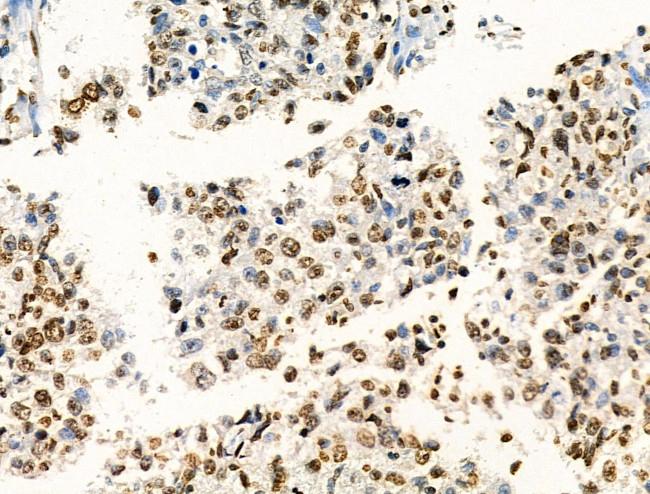 H2BK20ac Antibody in Immunohistochemistry (Paraffin) (IHC (P))