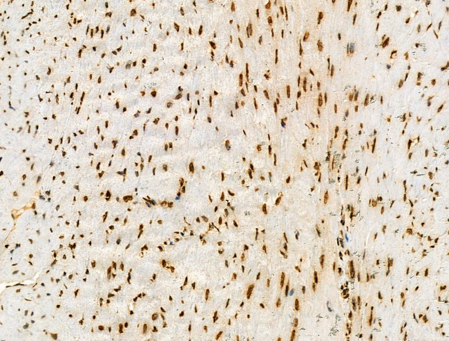 H2BK20ac Antibody in Immunohistochemistry (Paraffin) (IHC (P))