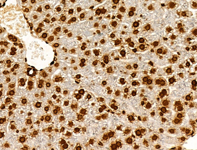 H2BK20ac Antibody in Immunohistochemistry (Paraffin) (IHC (P))