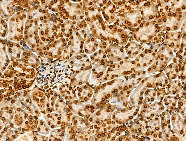 H2BK20ac Antibody in Immunohistochemistry (Paraffin) (IHC (P))