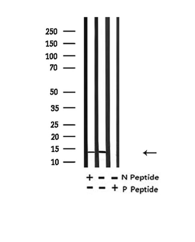 H2BK20ac Antibody in Western Blot (WB)