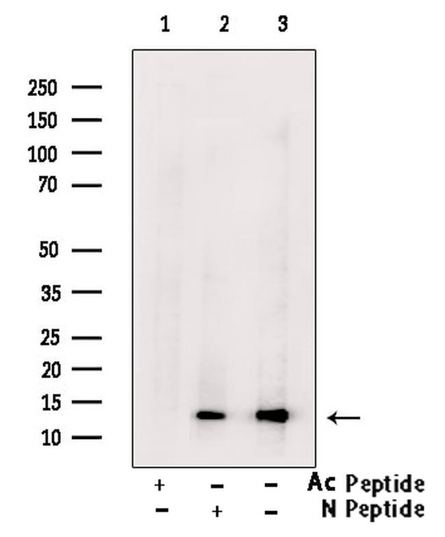 H2BK20ac Antibody in Western Blot (WB)