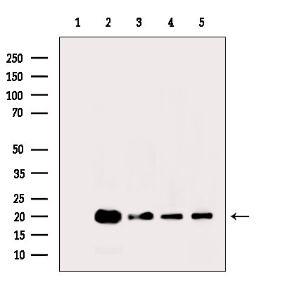 Histone H3ac (pan-acetyl) Antibody in Western Blot (WB)