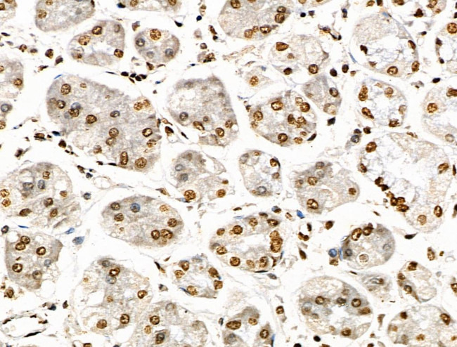 Histone H3ac (pan-acetyl) Antibody in Immunohistochemistry (Paraffin) (IHC (P))