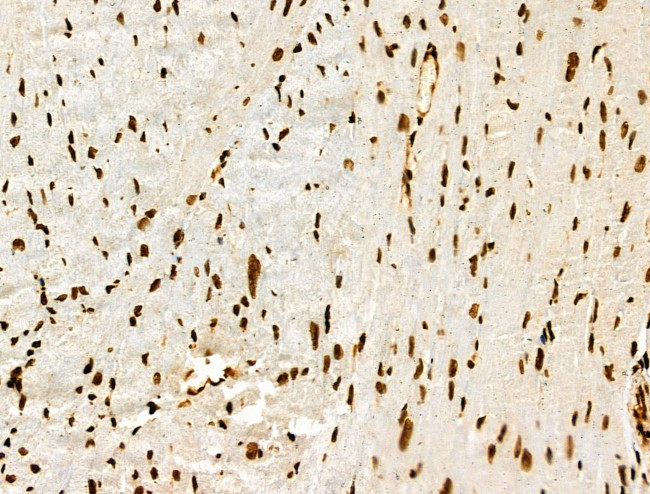 Histone H3ac (pan-acetyl) Antibody in Immunohistochemistry (Paraffin) (IHC (P))