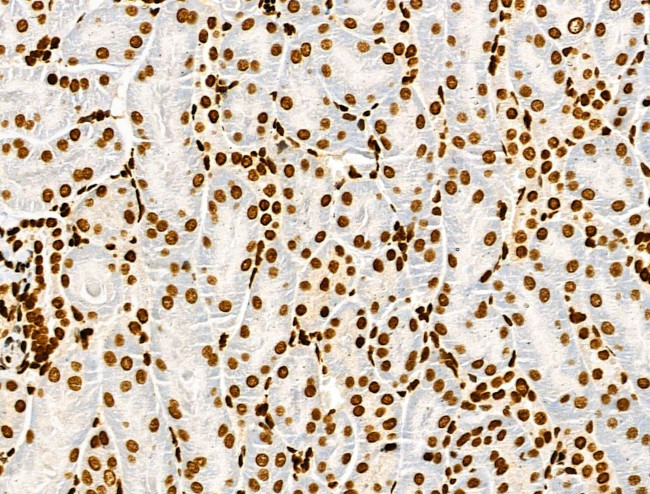 Histone H3ac (pan-acetyl) Antibody in Immunohistochemistry (Paraffin) (IHC (P))