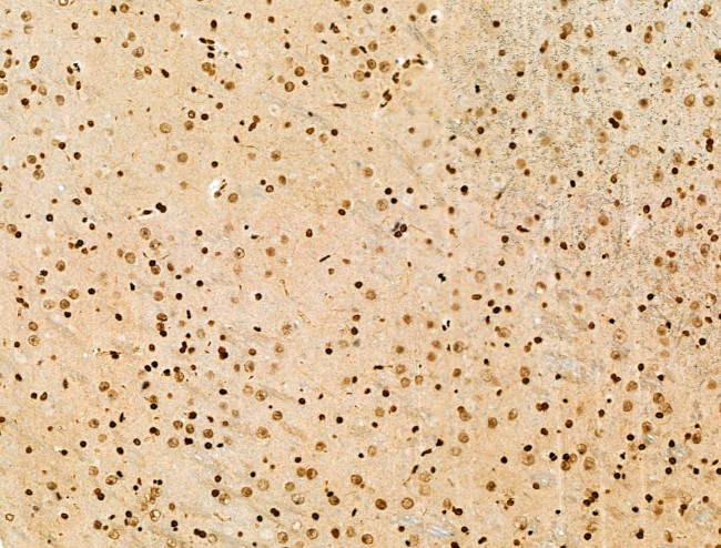 Histone H3ac (pan-acetyl) Antibody in Immunohistochemistry (Paraffin) (IHC (P))