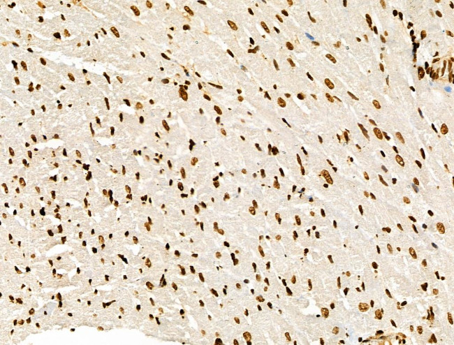 Histone H3ac (pan-acetyl) Antibody in Immunohistochemistry (Paraffin) (IHC (P))