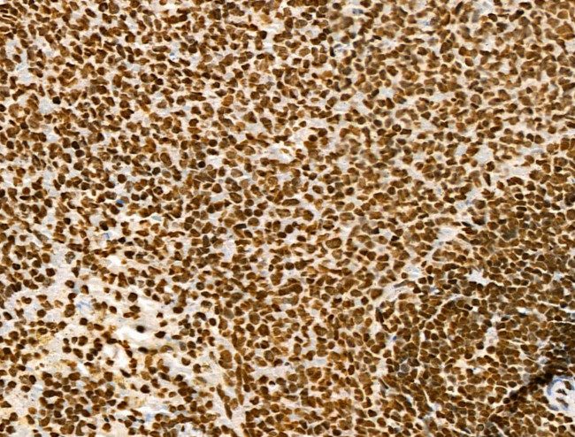 Histone H3ac (pan-acetyl) Antibody in Immunohistochemistry (Paraffin) (IHC (P))