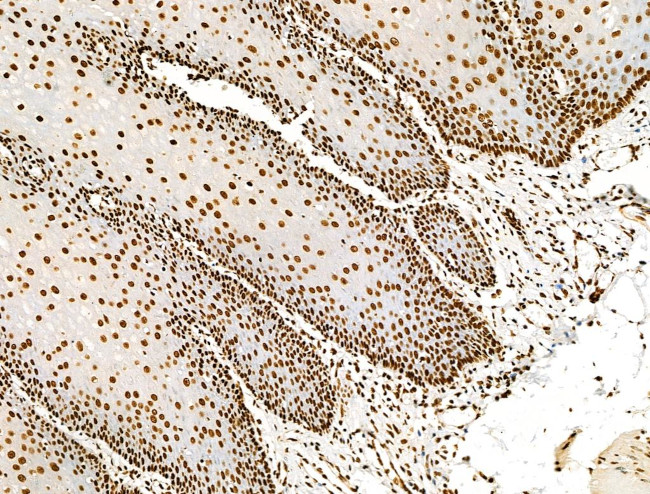 Histone H3ac (pan-acetyl) Antibody in Immunohistochemistry (Paraffin) (IHC (P))