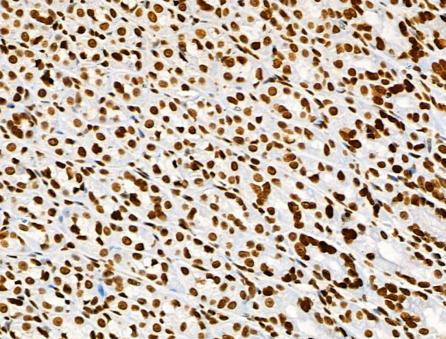 Histone H3ac (pan-acetyl) Antibody in Immunohistochemistry (Paraffin) (IHC (P))