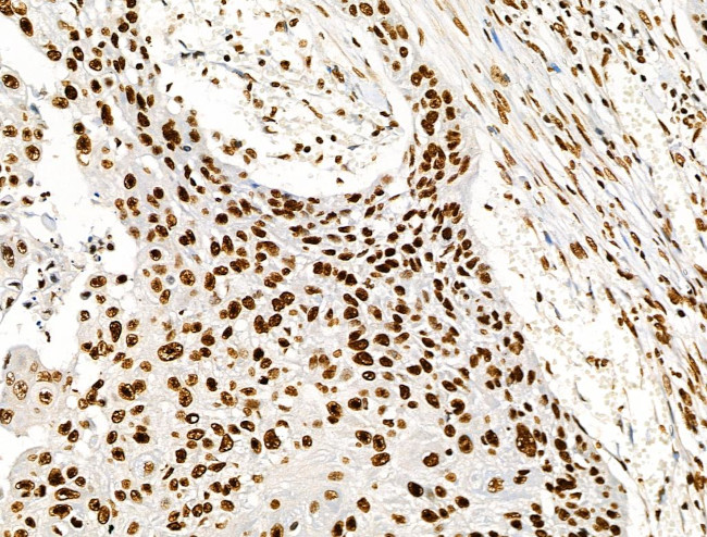 Histone H3ac (pan-acetyl) Antibody in Immunohistochemistry (Paraffin) (IHC (P))