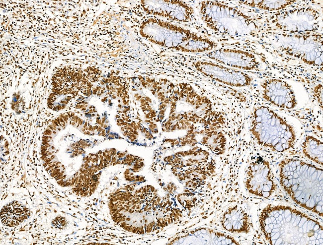 Histone H3ac (pan-acetyl) Antibody in Immunohistochemistry (Paraffin) (IHC (P))