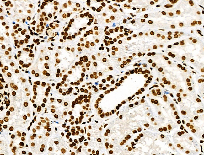 Histone H3ac (pan-acetyl) Antibody in Immunohistochemistry (Paraffin) (IHC (P))