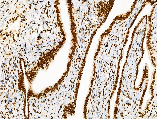 Histone H3ac (pan-acetyl) Antibody in Immunohistochemistry (Paraffin) (IHC (P))