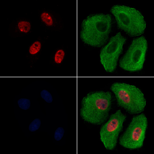 H4K12ac Antibody in Immunocytochemistry (ICC/IF)