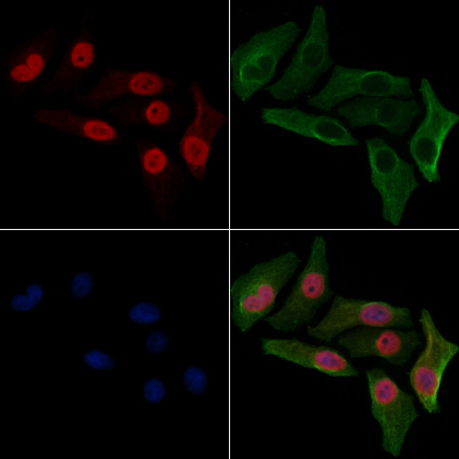 H4K12ac Antibody in Immunocytochemistry (ICC/IF)