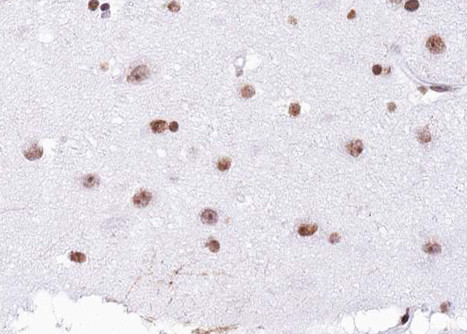 H4K12ac Antibody in Immunohistochemistry (Paraffin) (IHC (P))