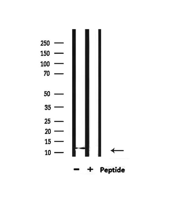 H4K12ac Antibody in Western Blot (WB)