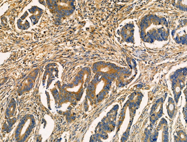 Acetyl-SOD2 (Lys68) Antibody in Immunohistochemistry (Paraffin) (IHC (P))