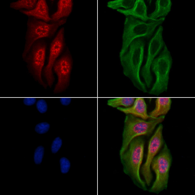 AEBP1 Antibody in Immunocytochemistry (ICC/IF)