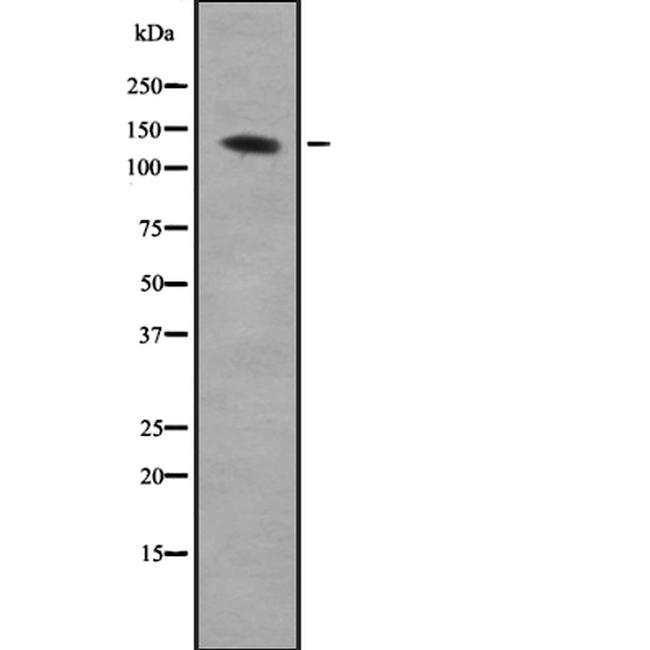 AEBP1 Antibody in Western Blot (WB)