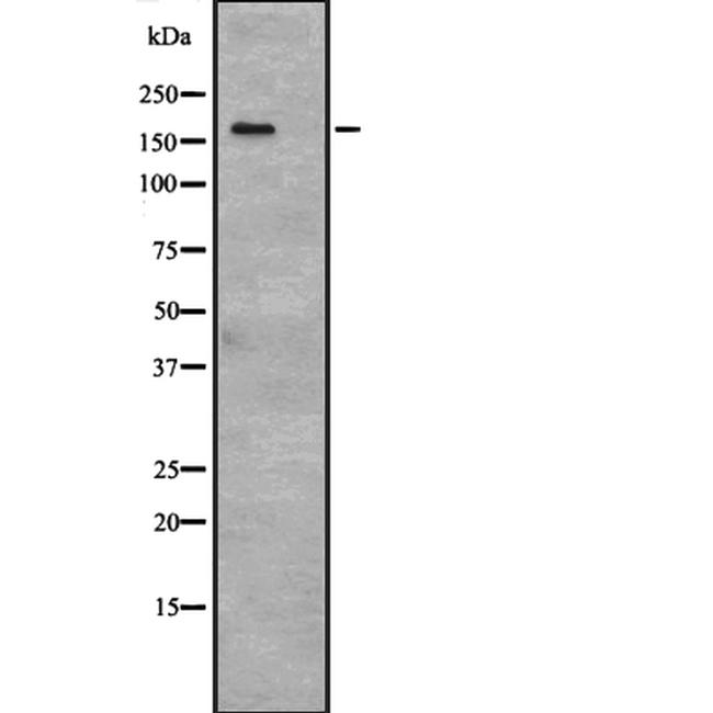 53BP2 Antibody in Western Blot (WB)