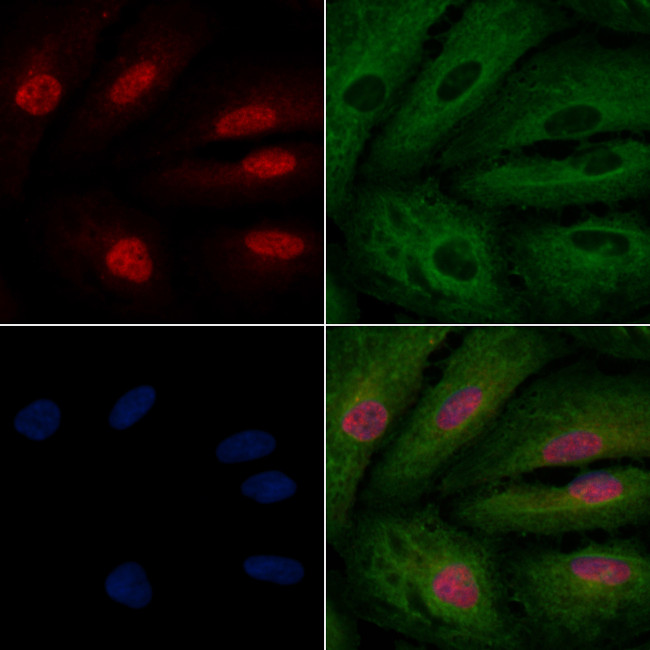 CCNK Antibody in Immunocytochemistry (ICC/IF)