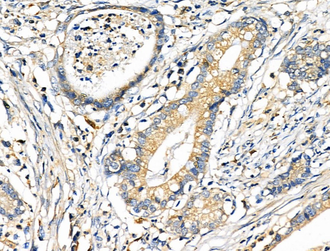 CD2AP Antibody in Immunohistochemistry (Paraffin) (IHC (P))