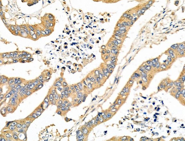 CD2AP Antibody in Immunohistochemistry (Paraffin) (IHC (P))