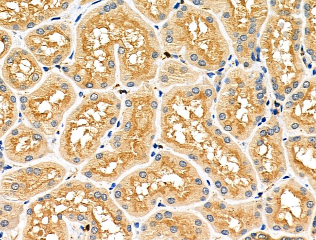 CD2AP Antibody in Immunohistochemistry (Paraffin) (IHC (P))