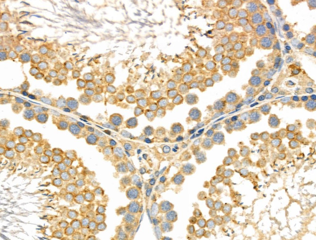 CD2AP Antibody in Immunohistochemistry (Paraffin) (IHC (P))