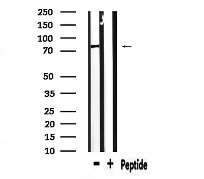 CD2AP Antibody in Western Blot (WB)