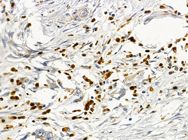 CD48 Antibody in Immunohistochemistry (Paraffin) (IHC (P))