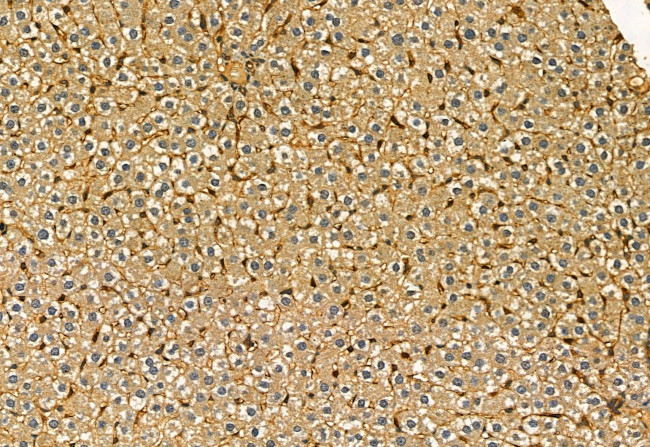 CD81 Antibody in Immunohistochemistry (Paraffin) (IHC (P))