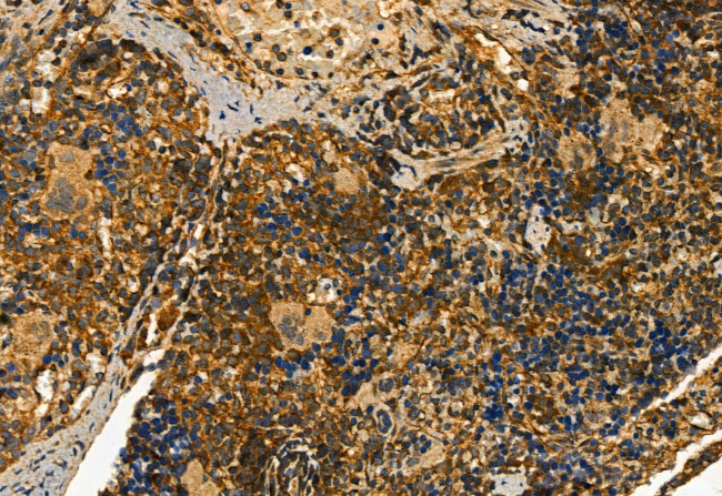 CD81 Antibody in Immunohistochemistry (Paraffin) (IHC (P))