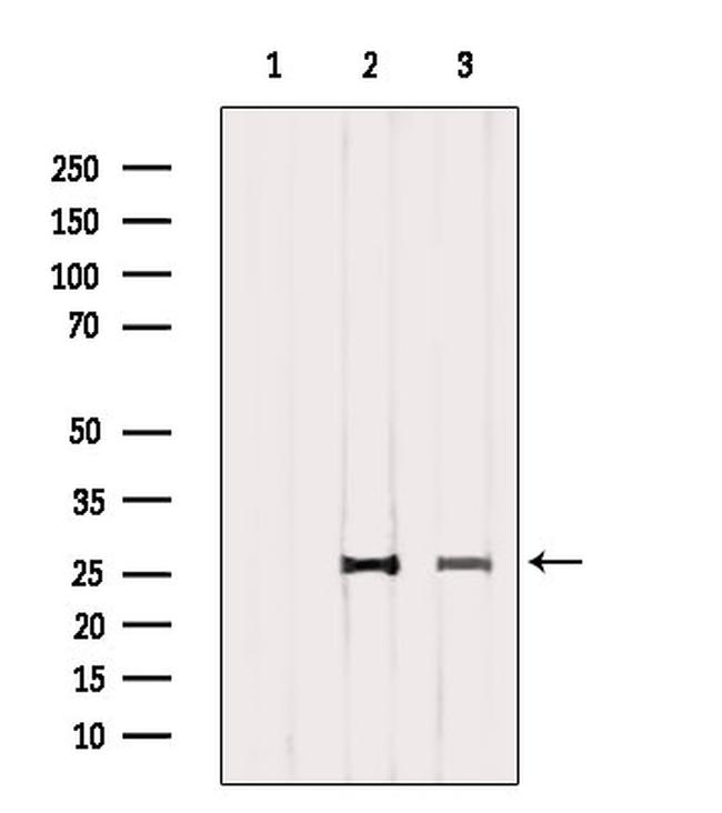 CD81 Antibody in Western Blot (WB)