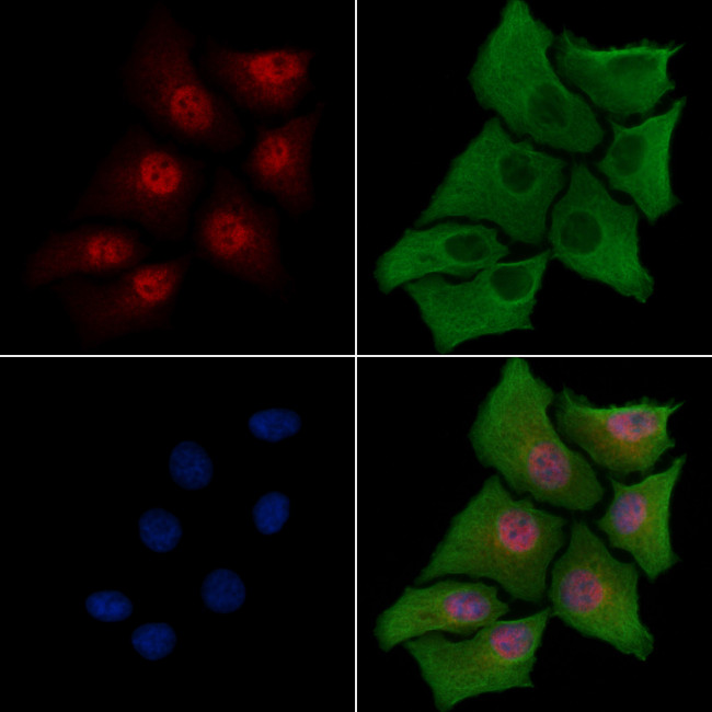 CITED2 Antibody in Immunocytochemistry (ICC/IF)