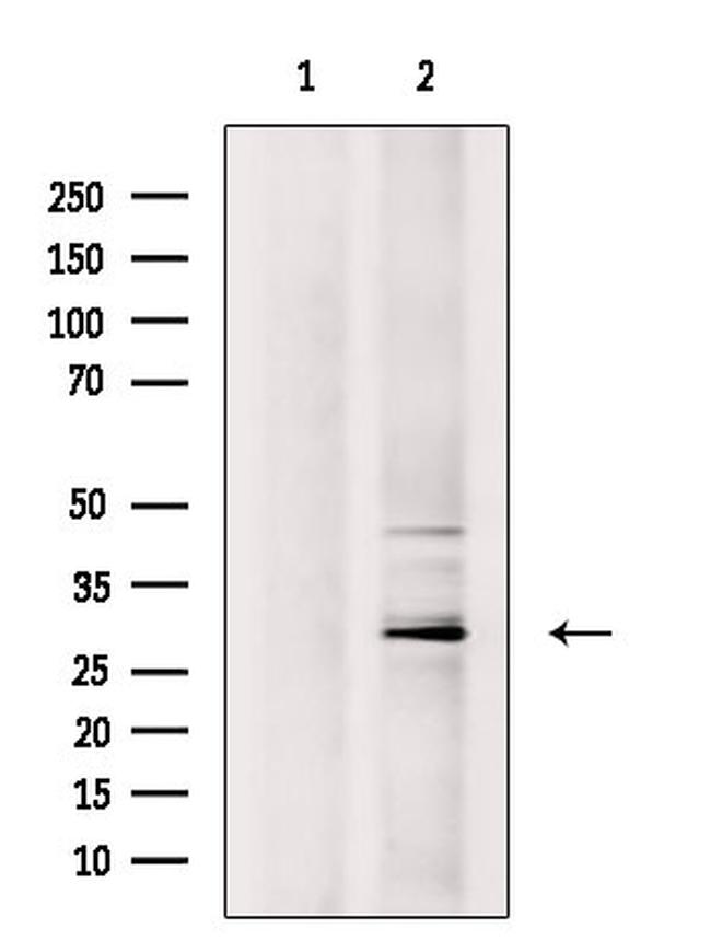 CITED2 Antibody in Western Blot (WB)