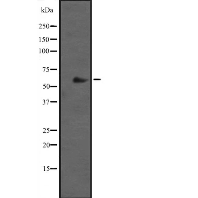 CYP2J2 Antibody in Western Blot (WB)