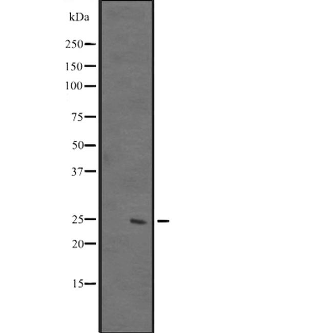 DUSP26 Antibody in Western Blot (WB)