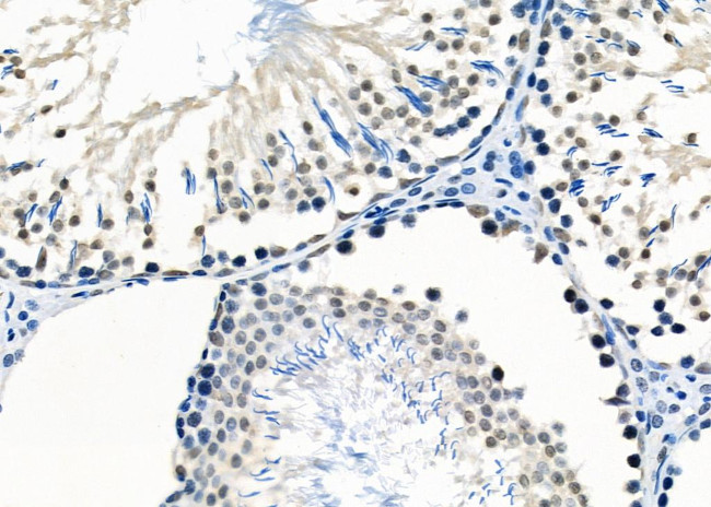 E2F7 Antibody in Immunohistochemistry (Paraffin) (IHC (P))