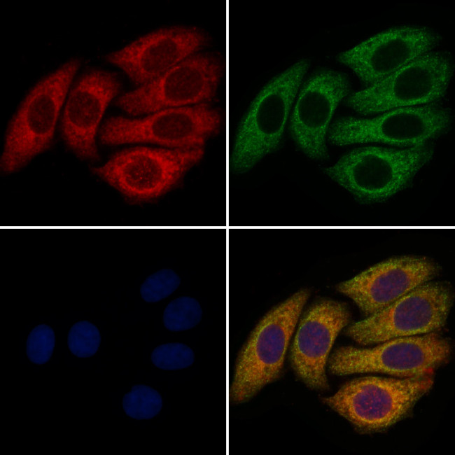 FGF8 Antibody in Immunocytochemistry (ICC/IF)