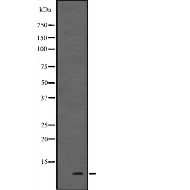 HOPX Antibody in Western Blot (WB)